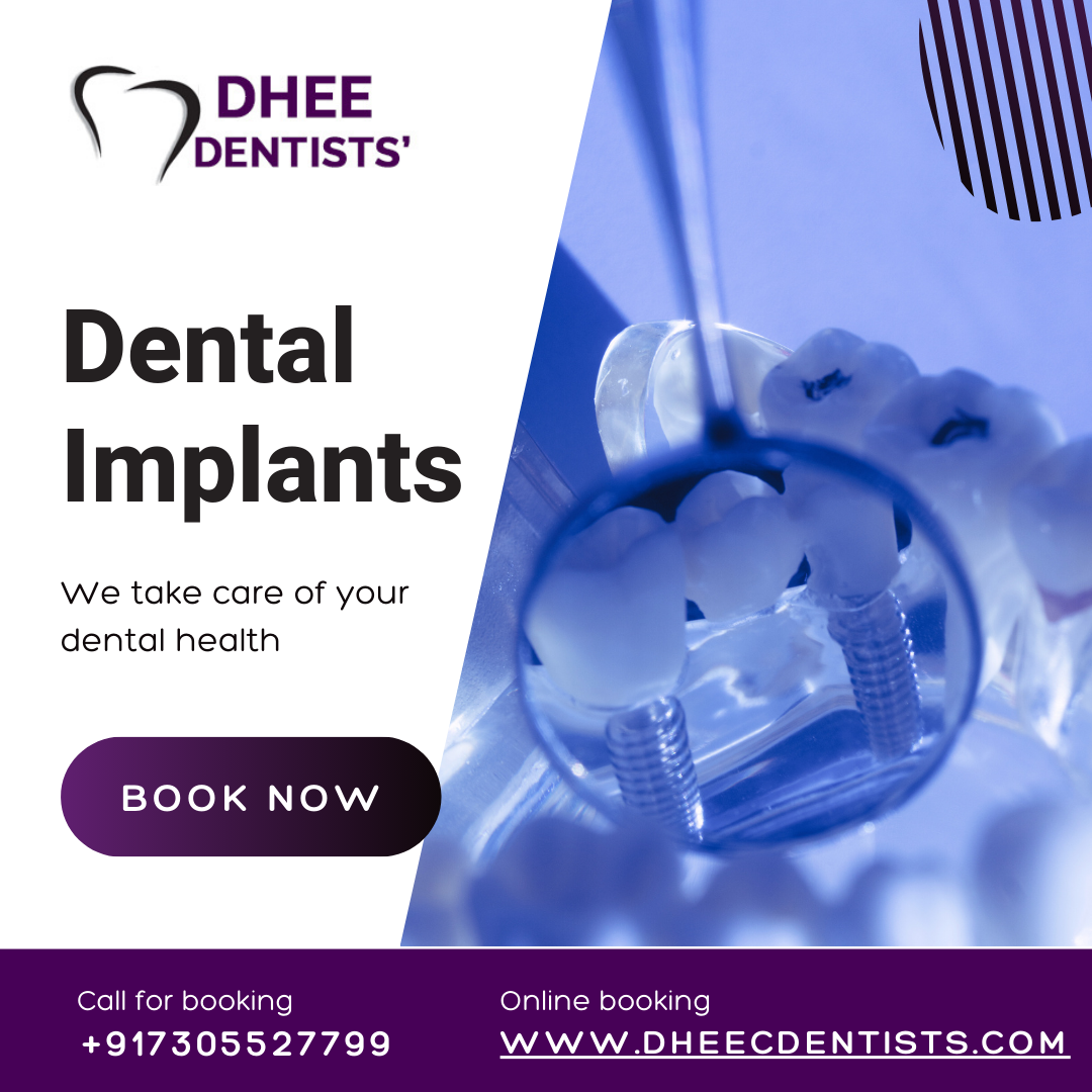 DEntal Implants