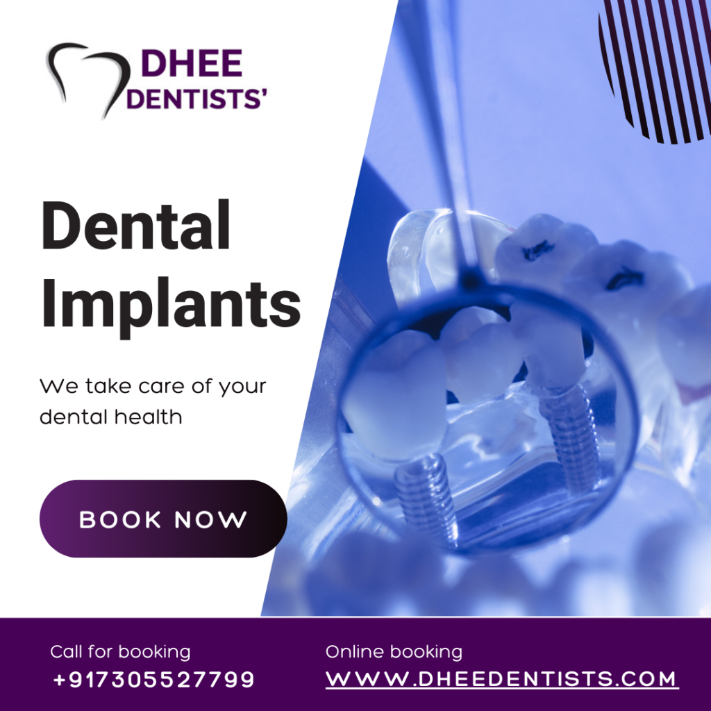 Dental Implants